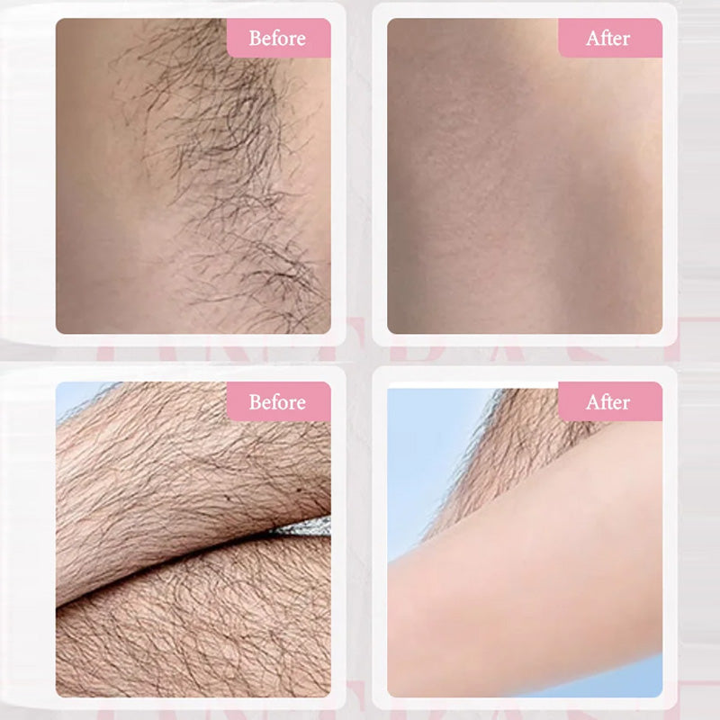 🔥HOT SALE 50% OFF🔥Gentle & Effective Hair Removal Cream